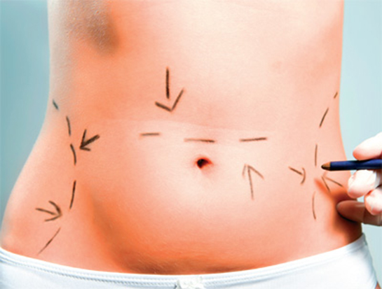 Mide Sarkması Belirtileri ve Tedavisi